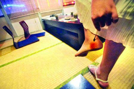 女顧客在料理店就餐被老鼠咬傷(圖)